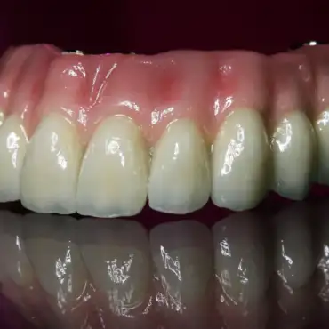 Zirconia Solutions