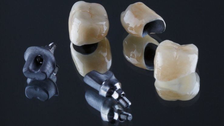 METAL CERAMICS